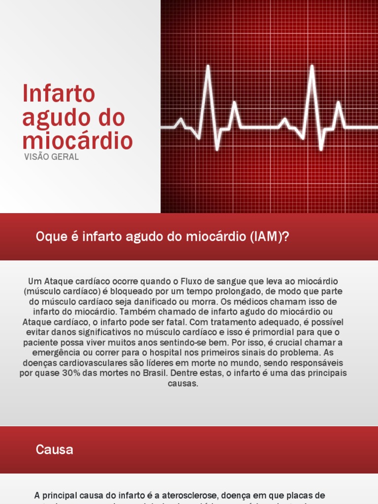 Causas e Tratamento do Infarto Agudo | PDF | Infarto do Miocárdio | Coração
