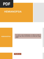 Homonymous Hemianopsia Espanol | PDF | Percepción visual | Carrera