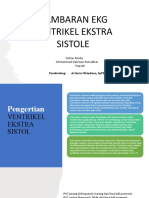 Ventrikel Estrasistol