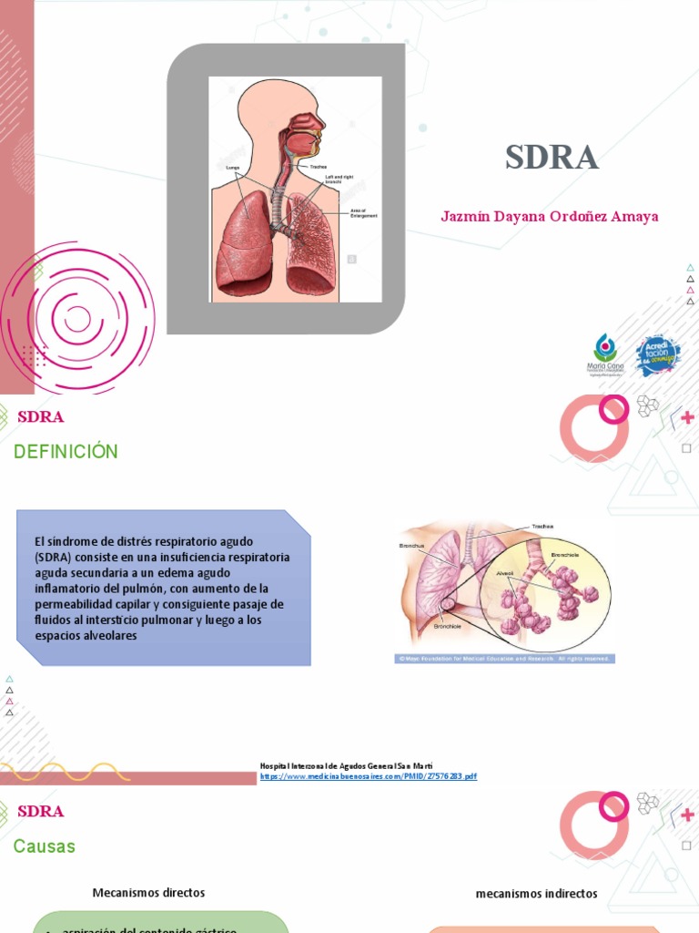 Fisiopatología y causas del SDRA | PDF | Pulmón | Neumonía