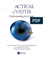 Uveitis William