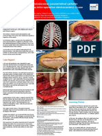 Inadvertent Retrolaminar Paravertebral Catheter Transection by Intra-Operative Electrocautery