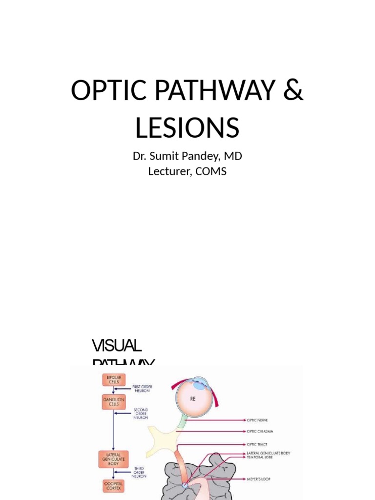Optic Pathway Lesions Overview | PDF | Light | Senses