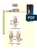 Artrosis y Artritis