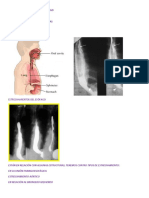 Anatomia Radiologica Del Esofago