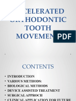 Accelerated Orthodontic Tooth Movement
