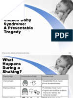 2 - 3 Shaken Baby Syndrome