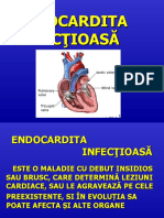 Endocardita infectioasa