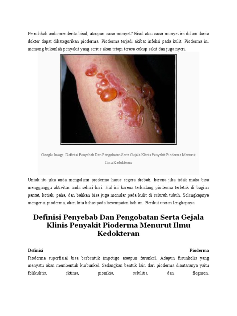 Penjelasan Lengkap Pioderma pada Anak | PDF | Sains & Matematika