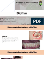 Placa dentobacteriana
