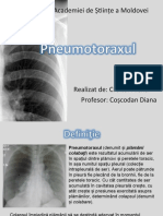 pneumotorax - boala respiatorie