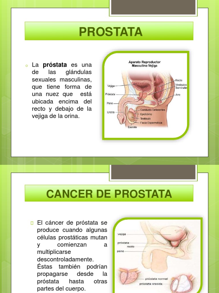 Antigenul specific prostatic (PSA)