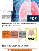 Enfermedad Pulmonar Obstructiva Crónica (EPOC)