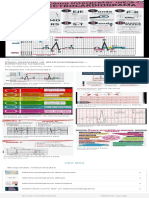 interpretacion del electrocardiograma - Búsqueda de Google