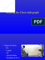 Reading The Chest Radiograph