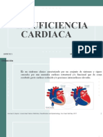 Insuficiencia Cardiaca