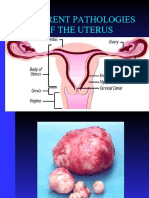 Different Pathologies of The Uterus