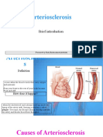 Arteriosclerosis: Causes, Symptoms, and Treatment