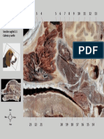 Sección Sagital 2.1 Cabeza y Cuello: Dor Cau Ros
