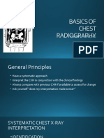 Basics of Chest Radiography Interpretation