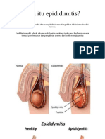 Epididimitis