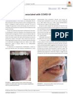 Oral Manifestations Associated With COVID-19: Letter To The Editor