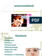 6.Epistaxis.ppt