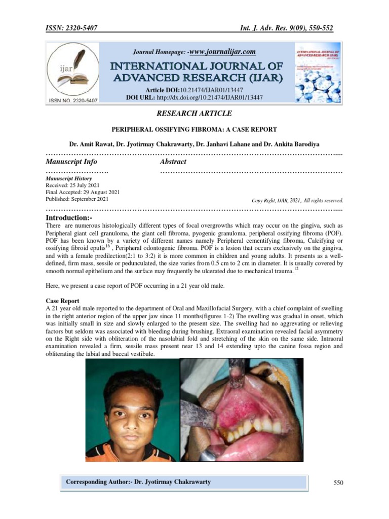 Peripheral Ossifying Fibroma A Case Report PDF Diseases And