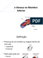 Trombose Venosa no Membro Inferior: Definição, Fatores de Risco e Tratamento