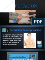 AMPUTACION