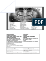 Caries Interproximal Materia