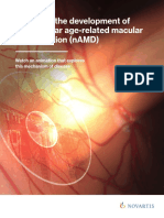 Exploring The Development of Neovascular Age-Related Macular Degeneration (nAMD)