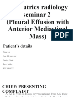 Radio Group F Pleural Effusion With Mediastinal Mass-2