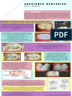 Preparaciones dentales infografía 