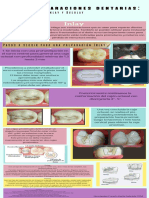 Preparaciones Dentales Infografía