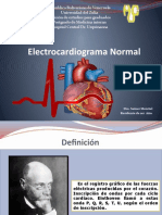 EKG Normal