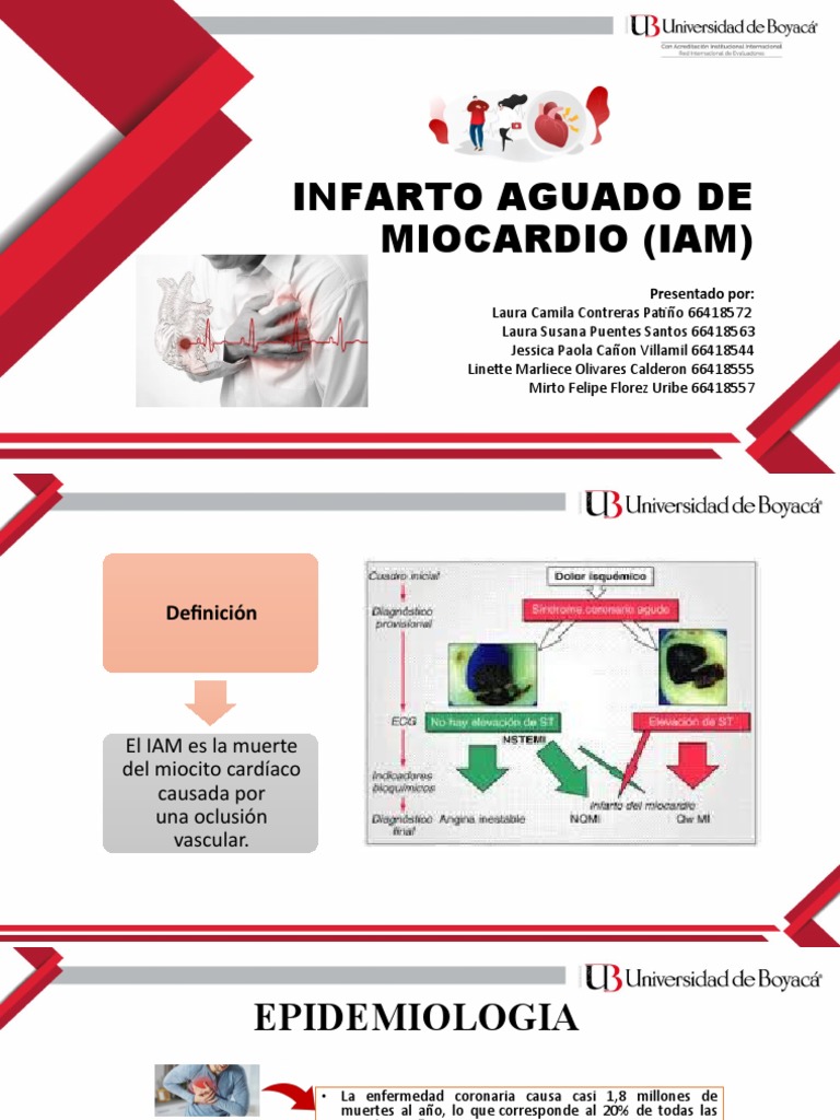 Infarto Aguado de Miocardio (Iam) | PDF | Infarto de miocardio | Isquemia