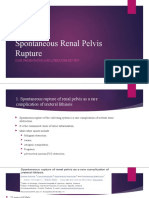 Spontaneous Renal Pelvis Rupture: Case Presentation and Literature Review