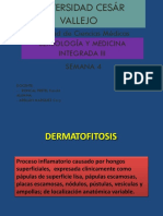 dermatofitosis 