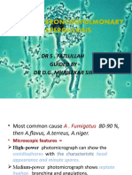 Allergic Bronchopulmonary Aspergillosis: DR S - Fazlullah Guided by DR D.G. Mhaisekar Sir