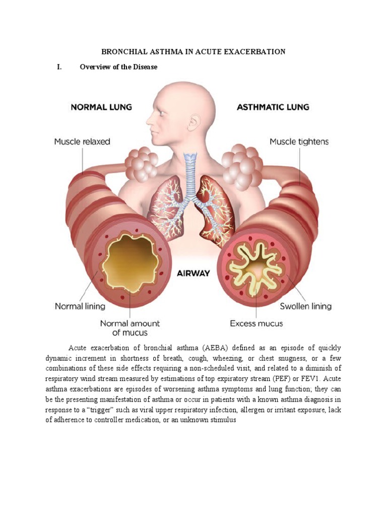 case study on asthma scribd