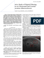 A Comparative Study of Digital Filtering Techniques in Ultrasound and Carotid Bifurcation Atherosclerosis-Min