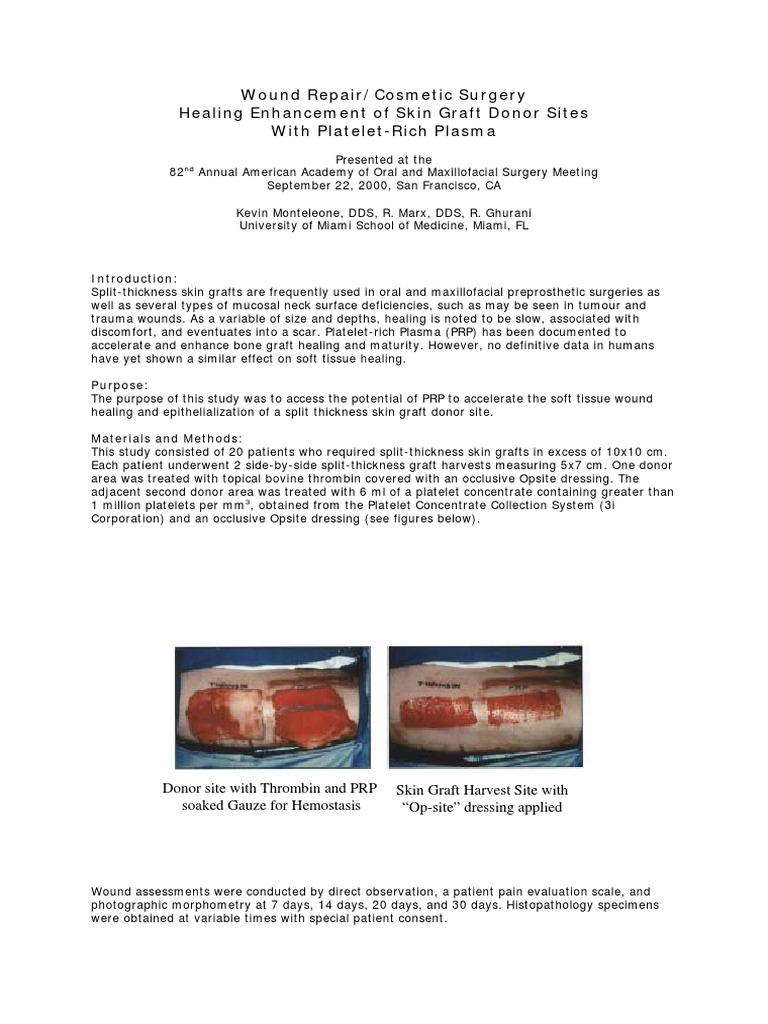 Monteleone Marx 2000 PRP Vs Thrombin in Skin Graft Donor Site Repair