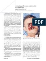 An Intraoral-Extraoral Combination Prosthesis Using An Intermediate Framework and Magnets: A Clinical Report