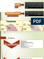 Expo Tendinitis y Tendinosis