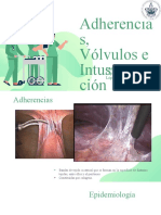 Adherencias, Vólvulos e Intuscepción