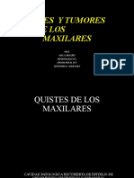 Quistes y Tumores de Los Maxilares