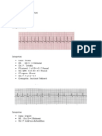 Kartika Budhi Pertiwi - Ners - EKG