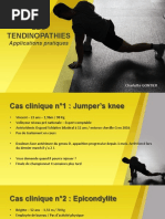 Protocole Stanish Et Alfredson | PDF | Tendon | Genou