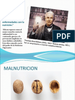 DESNUTRICION